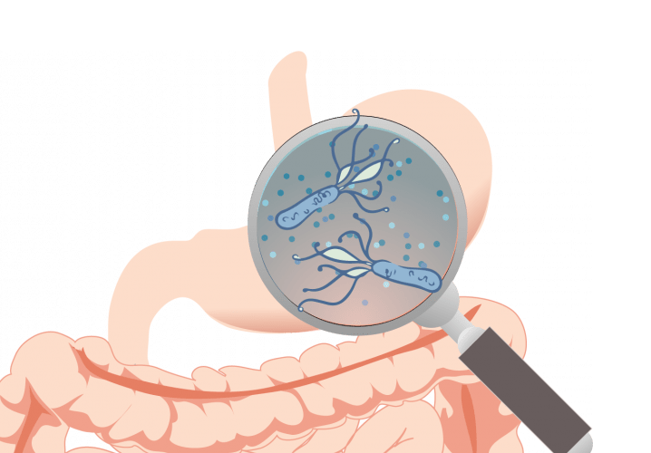 helicobacter pylori